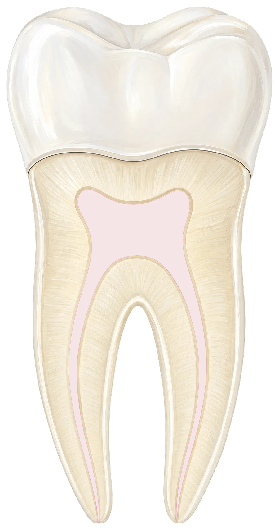 Illustration of a molar cut open to show its root canals being cleaned